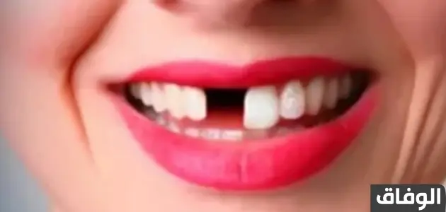 تفسير حلم سقوط الاسنان بدون دم
