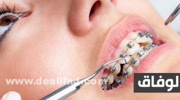 علاج اعوجاج الأسنان بدون تقويم