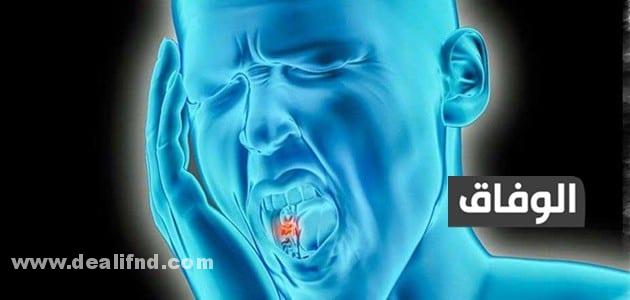 تسكين ألم الأسنان العصب