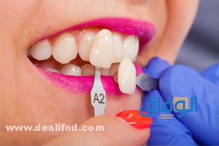 علاج الأسنان البارزة دون تقويم
