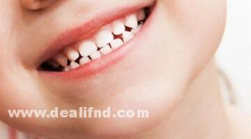 نسبة الفلورايد في معجون الأسنان للاطفال