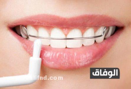 علاج اعوجاج الأسنان بدون تقويم