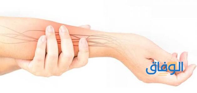 علاج اختناق عصب اليد بدون جراح