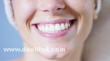 علاج الأسنان البارزة بدون تقويم