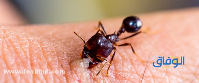 علاج قرصة النمل