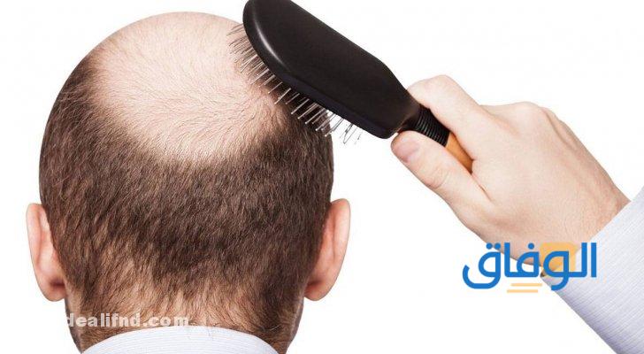 معالجة تساقط الشعر