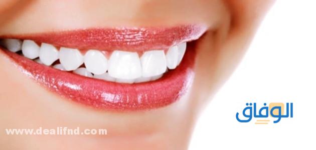 مميزات فينير الأسنان